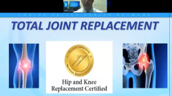 Dr. Componovo Discusses Total Joint Replacement